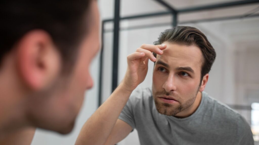 Fases de crecimiento injerto capilar