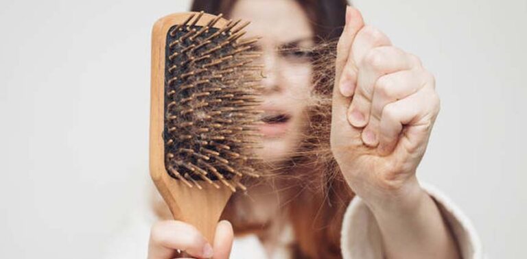 caida del pelo en mujeres