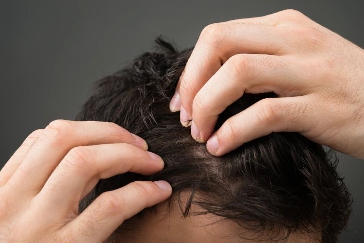 pelo caida
