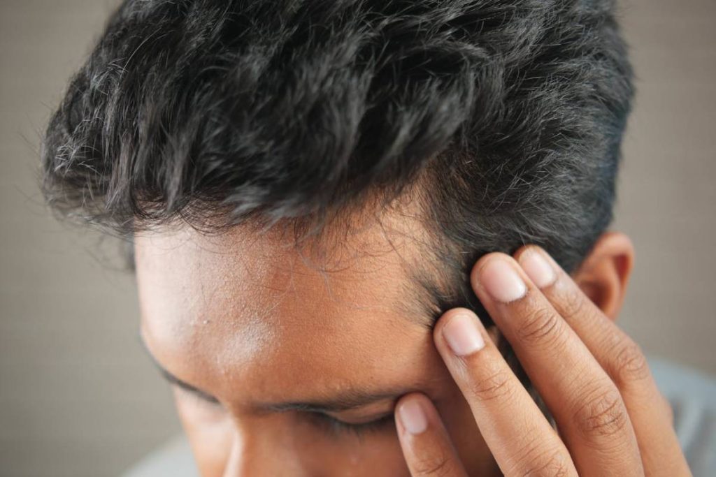 minoxidil tratamiento